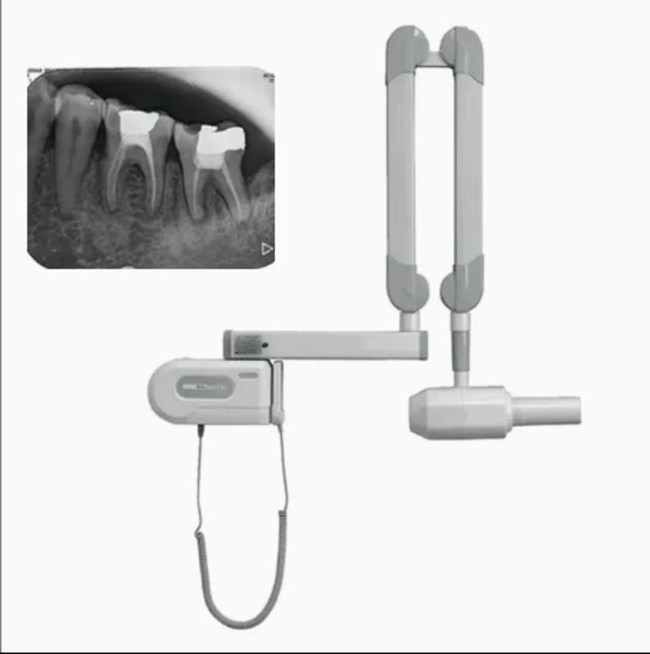 Digital X-ray System